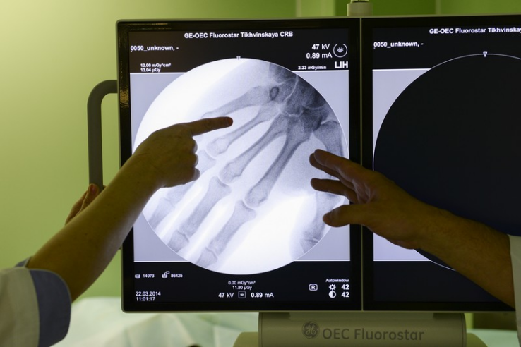 НАЦПРОЕКТЫ: в области внедряют цифровой рентген
