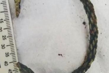 В Волосовском районе найдено древнее захоронение